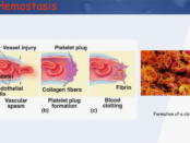 Hemostasis Diagnostics