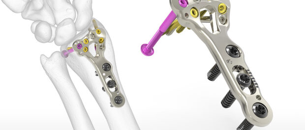 Small Bone and Joint Orthopedic Devices