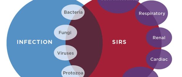 Systemic Inflammatory Response Syndrome Treatment Market