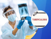 Tuberculosis Testing