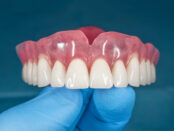 mouth dental implants
