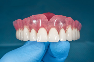 mouth dental implants