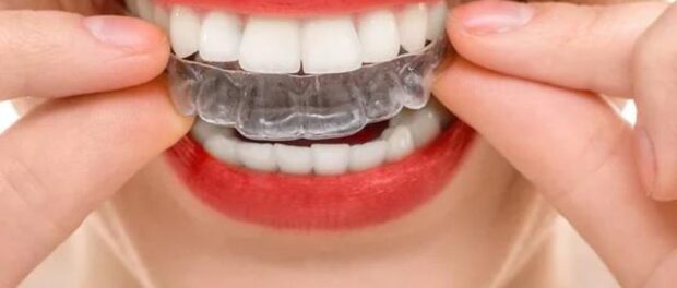 Invisalign El Paso - Cielo Dental & Orthodontics