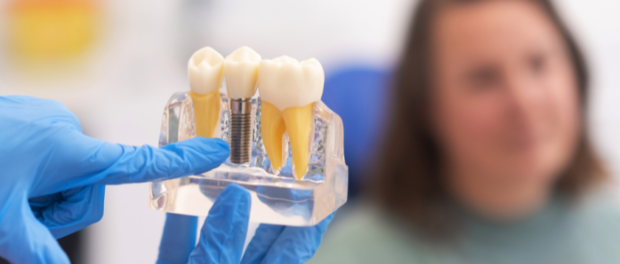 Dental Implants Henderson