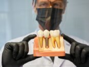 Dental Implants in Denton