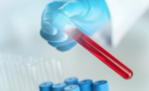 Liquid Biopsy Market