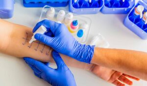 Antibiotic Susceptibility Testing Market