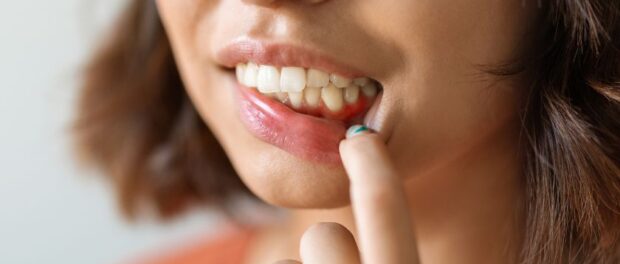 A woman showing her gums