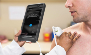 Handheld Ultrasound Scanner Market