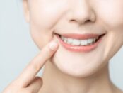 Teeth Whitening Treatment in Magnolia