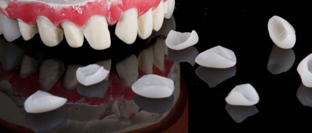 Dental Crown