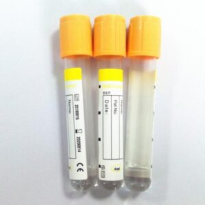 Serum Separation Gels Market