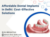 BestDentalImplantClinicInDelhi