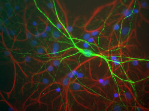 Anti-Neurofilament L Antibody Market