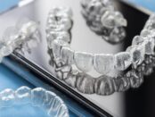 Invisalign Treatment