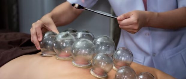 Cupping Therapy