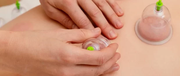 Cupping Massage in Clerkenwell