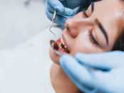 orthodontist in Queens NY