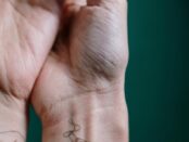 Texas Rheumatology Care